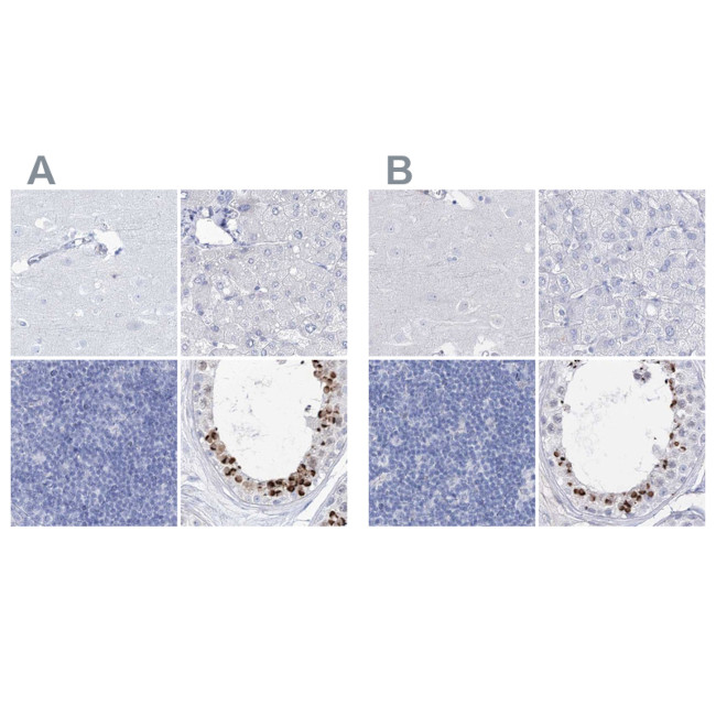 Acrosomal Vesicle Protein Antibody in Immunohistochemistry (IHC)