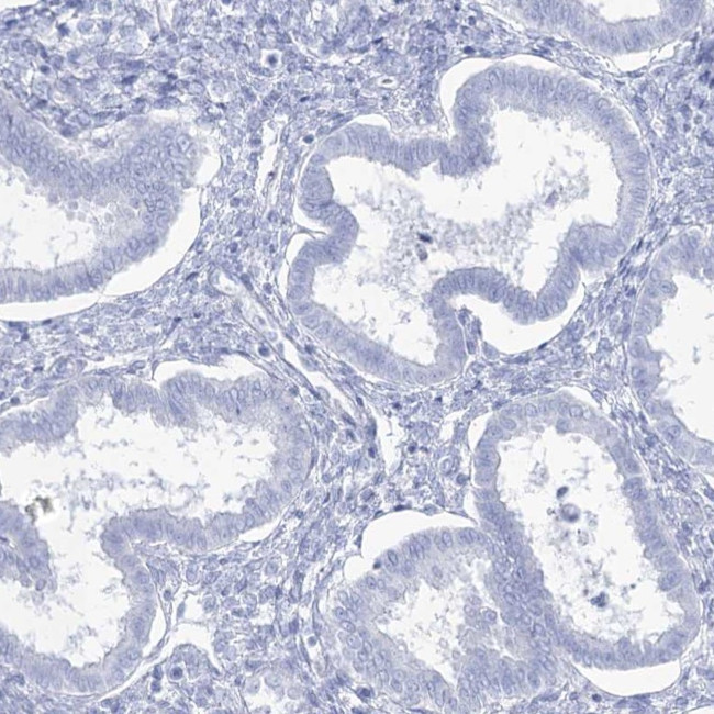 Acrosomal Vesicle Protein Antibody in Immunohistochemistry (IHC)