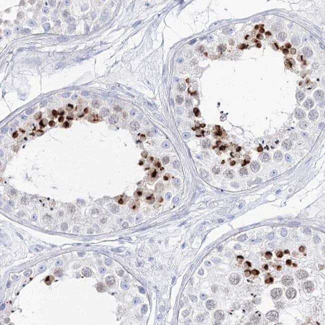 Acrosomal Vesicle Protein Antibody in Immunohistochemistry (IHC)