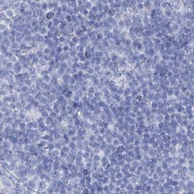 Acrosomal Vesicle Protein Antibody in Immunohistochemistry (IHC)