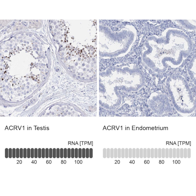 Acrosomal Vesicle Protein Antibody in Immunohistochemistry (IHC)