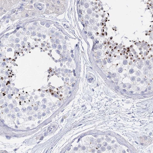 Acrosomal Vesicle Protein Antibody in Immunohistochemistry (IHC)