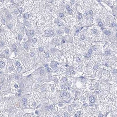 Acrosomal Vesicle Protein Antibody in Immunohistochemistry (IHC)