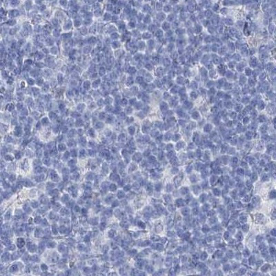 Acrosomal Vesicle Protein Antibody in Immunohistochemistry (IHC)