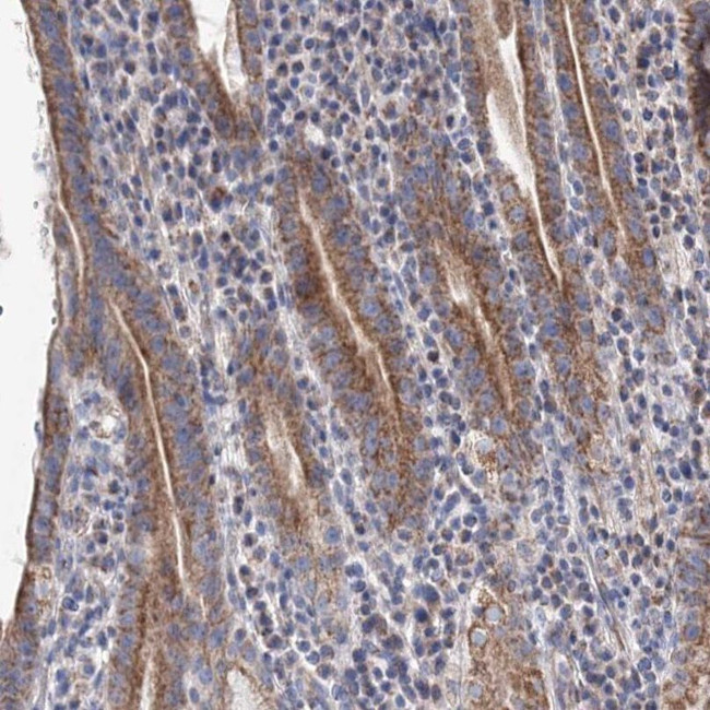 YARS2 Antibody in Immunohistochemistry (IHC)