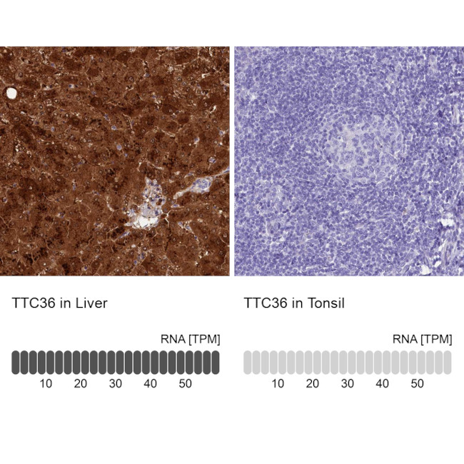 TTC36 Antibody in Immunohistochemistry (IHC)