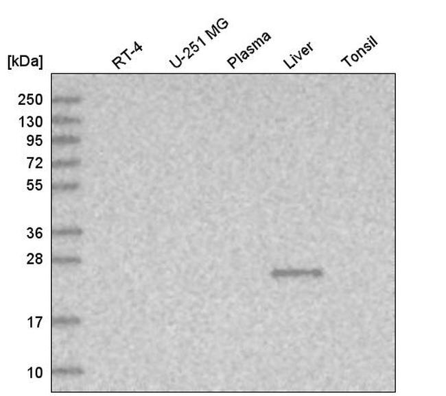 TTC36 Antibody in Western Blot (WB)