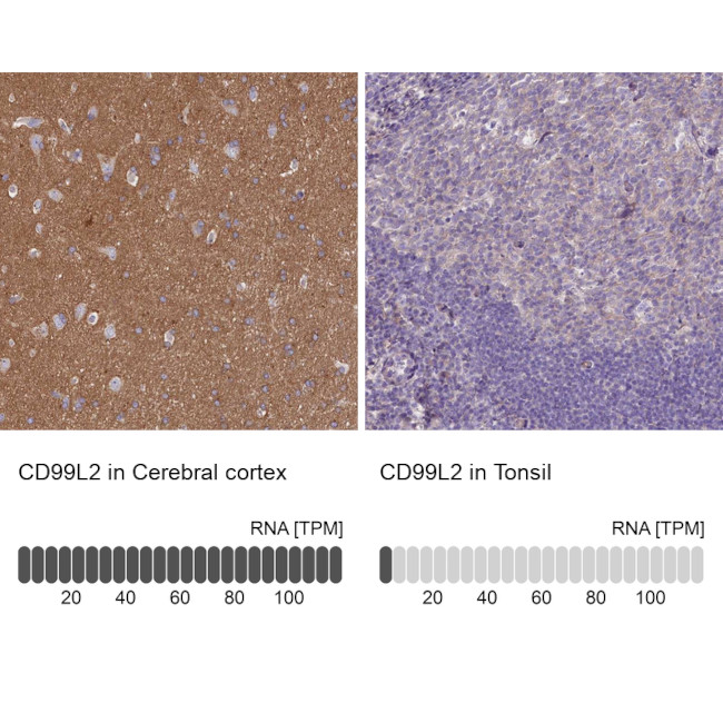 CD99L2 Antibody in Immunohistochemistry (IHC)