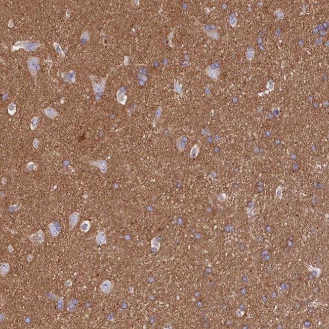 CD99L2 Antibody in Immunohistochemistry (IHC)