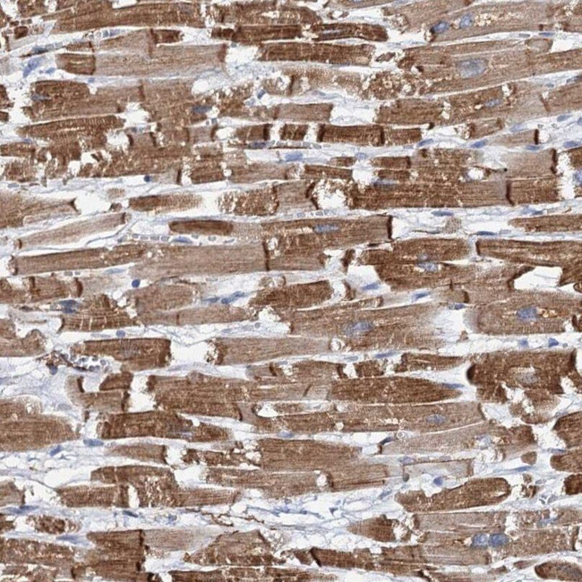 MURF2 Antibody in Immunohistochemistry (IHC)