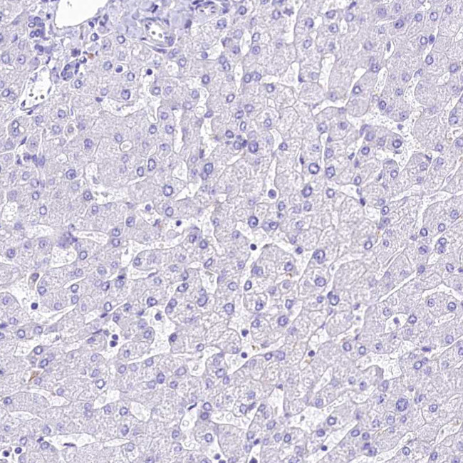 A2ML1 Antibody in Immunohistochemistry (IHC)