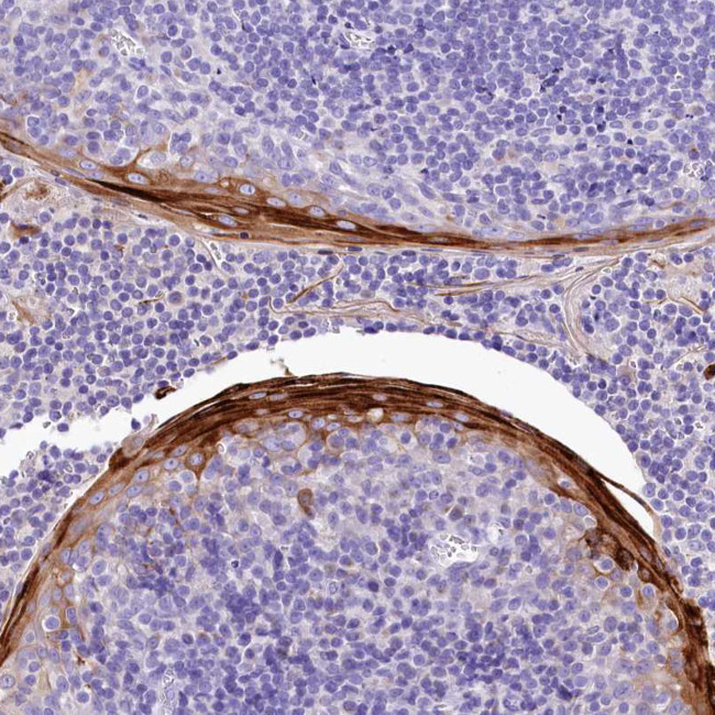 A2ML1 Antibody in Immunohistochemistry (IHC)