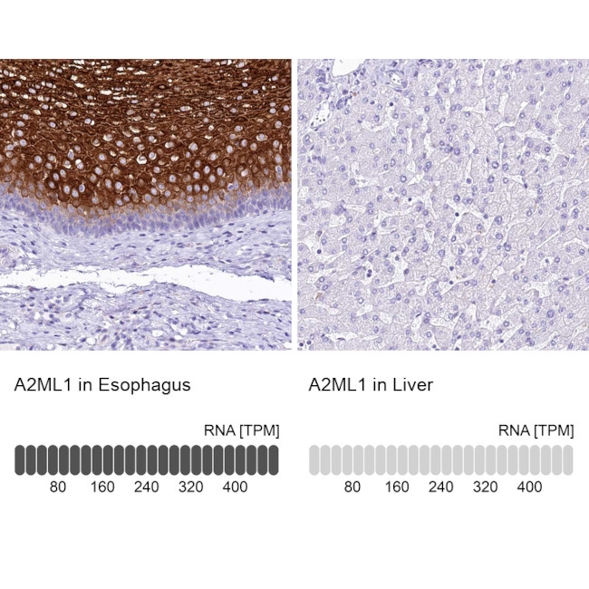 A2ML1 Antibody