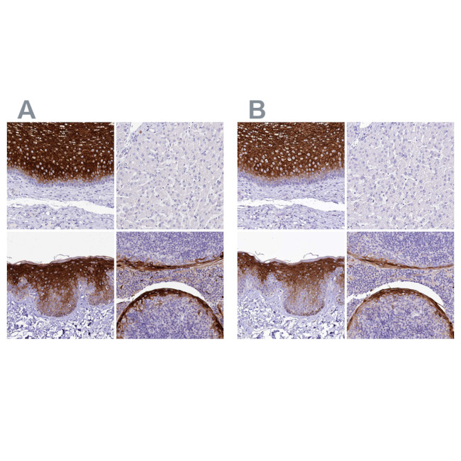 A2ML1 Antibody in Immunohistochemistry (IHC)