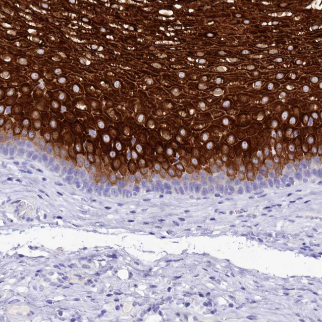 A2ML1 Antibody in Immunohistochemistry (IHC)