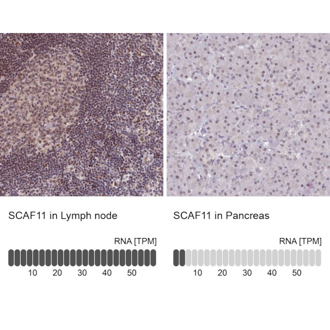 SCAF11 Antibody in Immunohistochemistry (IHC)