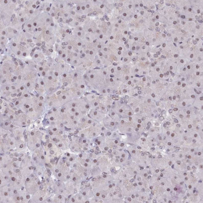 SCAF11 Antibody in Immunohistochemistry (IHC)