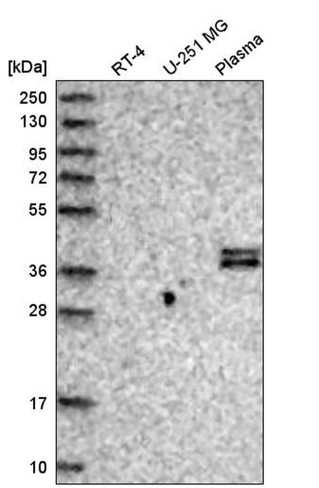 CFHR1 Antibody in Western Blot (WB)