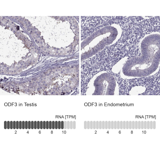 ODF3 Antibody in Immunohistochemistry (IHC)