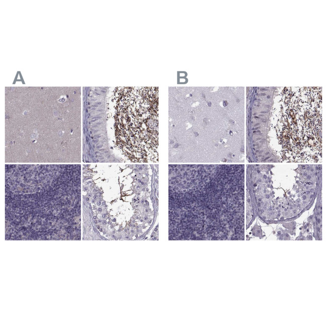 ODF3 Antibody in Immunohistochemistry (IHC)