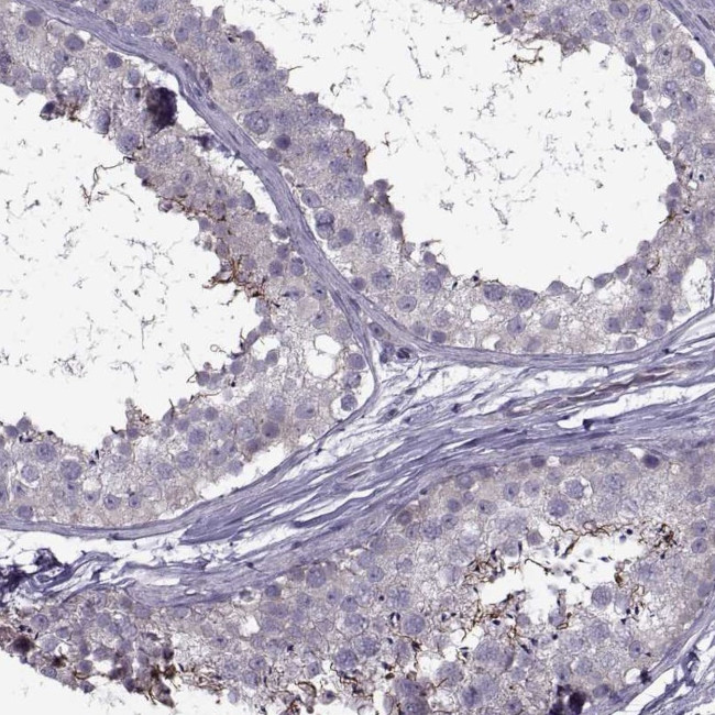 ODF3 Antibody in Immunohistochemistry (IHC)