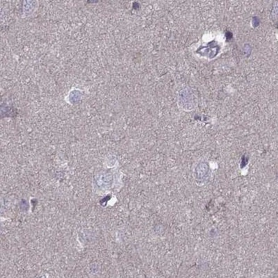 ODF3 Antibody in Immunohistochemistry (IHC)