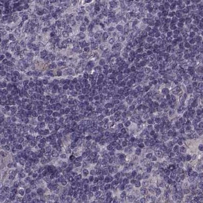 ODF3 Antibody in Immunohistochemistry (IHC)