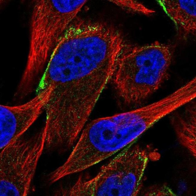 CFHR1 Antibody in Immunocytochemistry (ICC/IF)