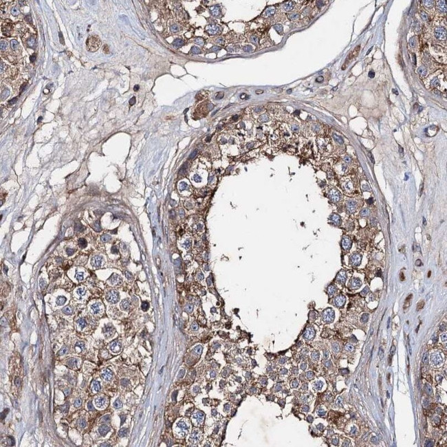 PTDSS2 Antibody in Immunohistochemistry (IHC)