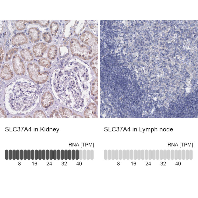 SLC37A4 Antibody in Immunohistochemistry (IHC)