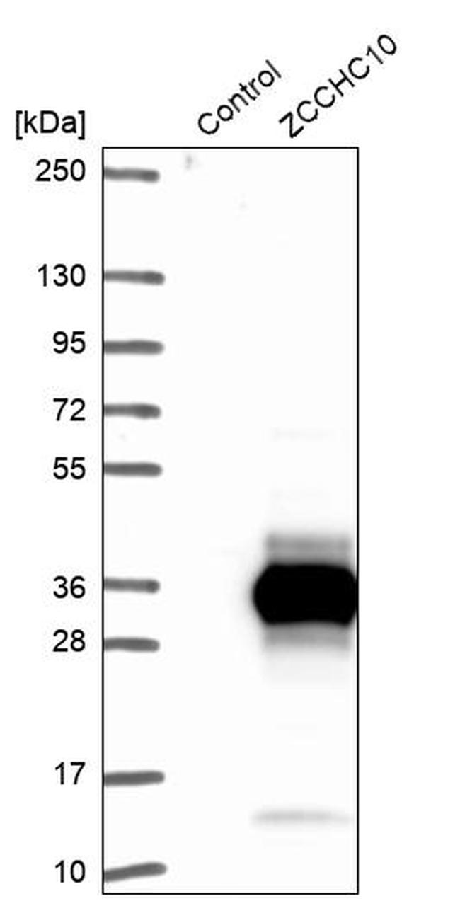 ZCCHC10 Antibody in Western Blot (WB)