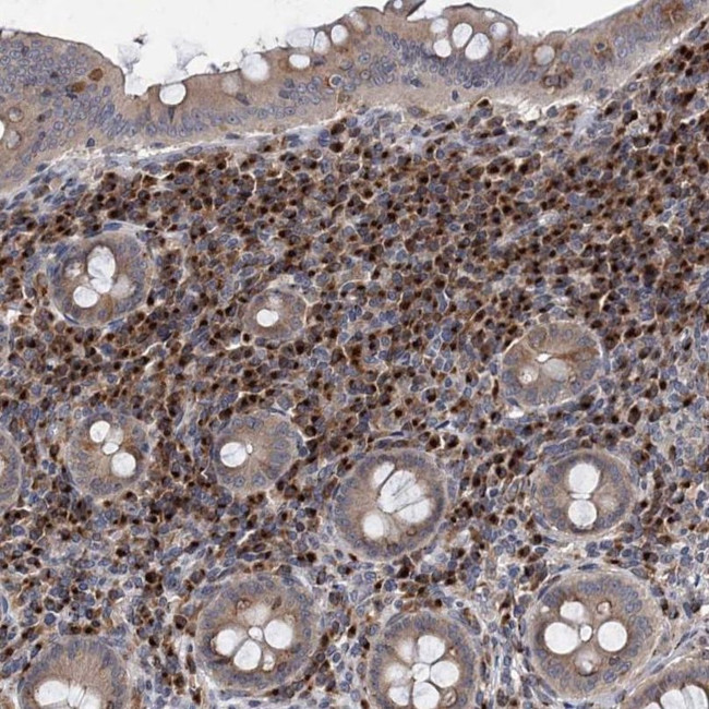 SAAL1 Antibody in Immunohistochemistry (IHC)