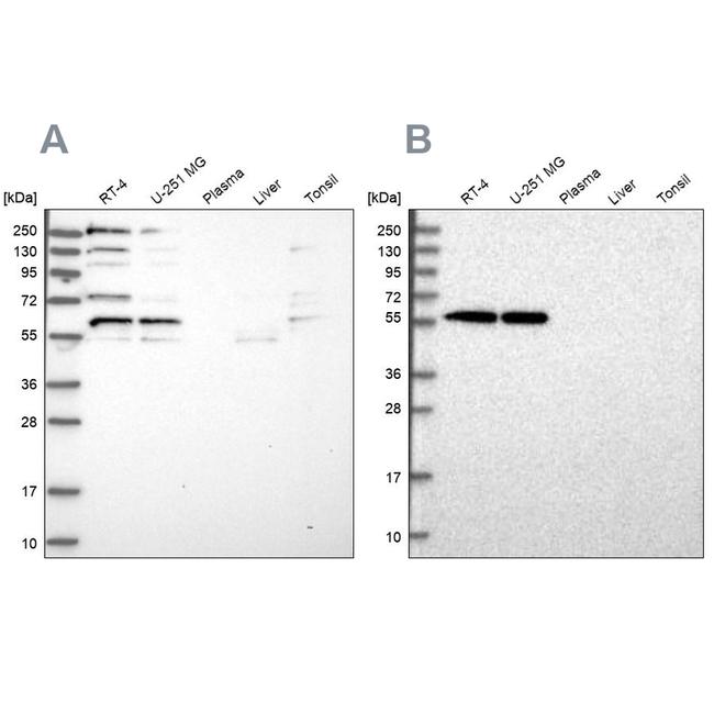 SAAL1 Antibody in Western Blot (WB)