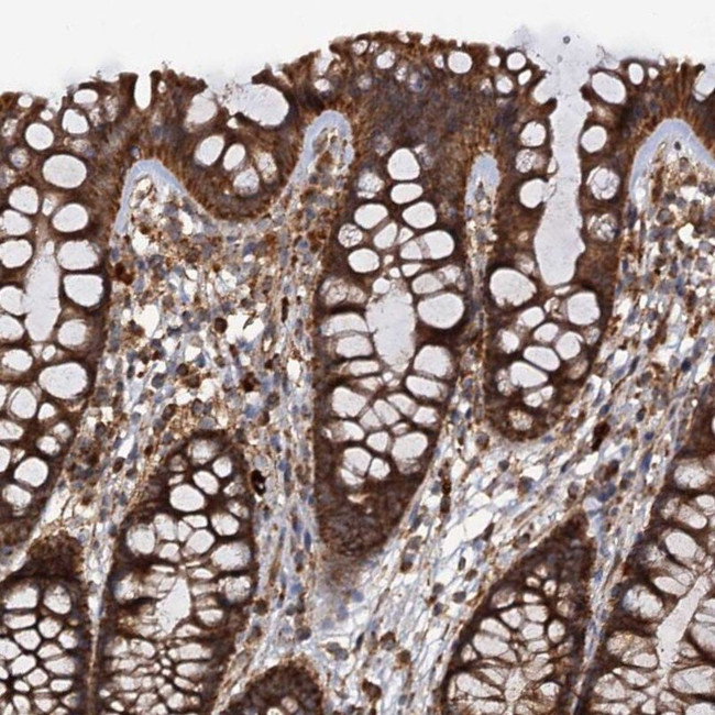 Importin 4 Antibody in Immunohistochemistry (IHC)