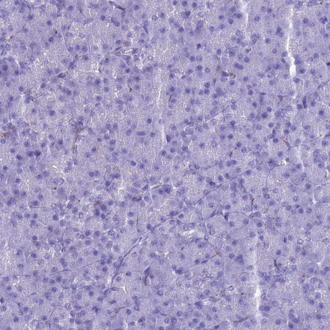 MAP6 Antibody in Immunohistochemistry (IHC)