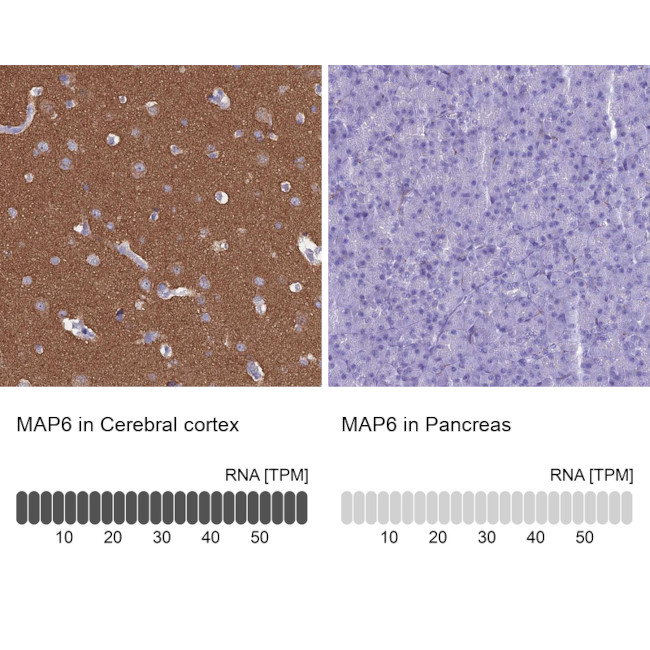 MAP6 Antibody