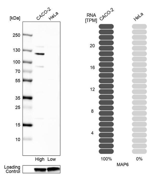 MAP6 Antibody in Western Blot (WB)