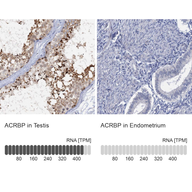 ACRBP Antibody in Immunohistochemistry (IHC)