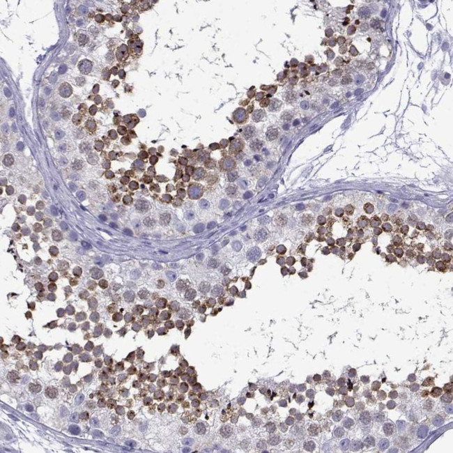 ACRBP Antibody in Immunohistochemistry (IHC)