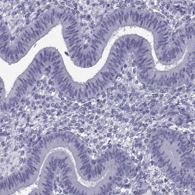 ACRBP Antibody in Immunohistochemistry (IHC)