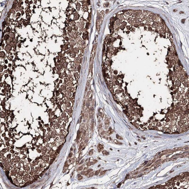 ZNF662 Antibody in Immunohistochemistry (IHC)