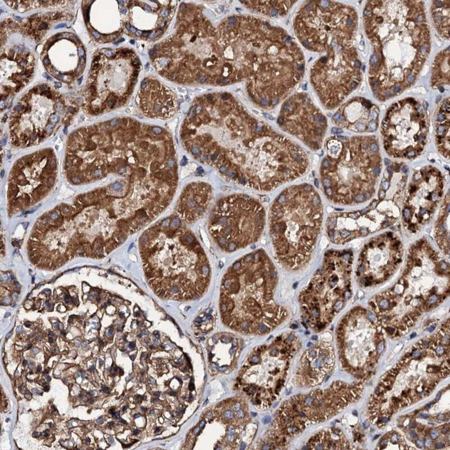 INTS10 Antibody in Immunohistochemistry (IHC)