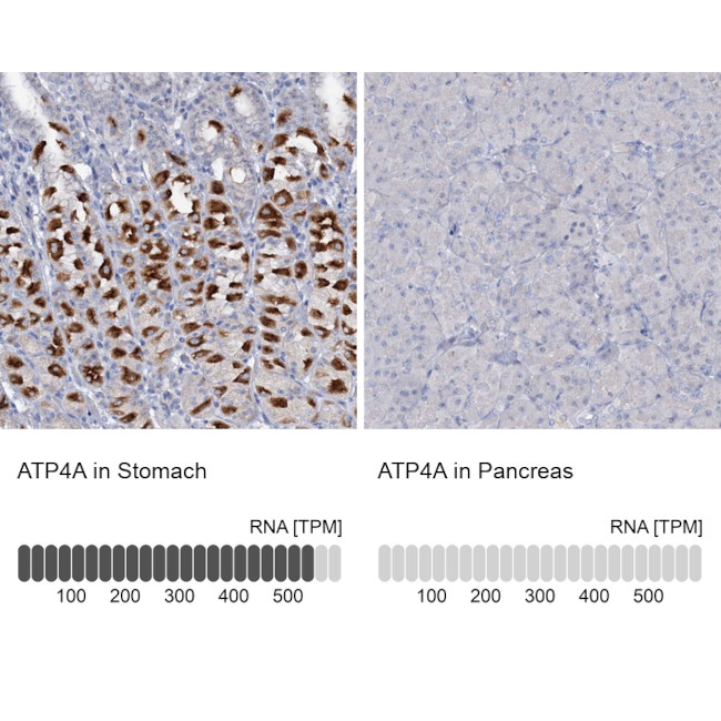 ATP4A Antibody in Immunohistochemistry (IHC)