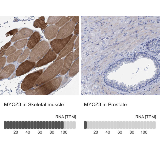 MYOZ3 Antibody in Immunohistochemistry (IHC)