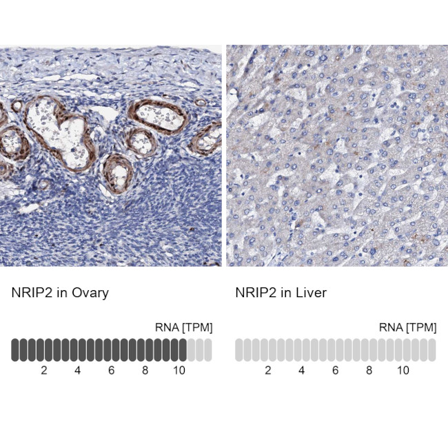 NRIP2 Antibody in Immunohistochemistry (IHC)