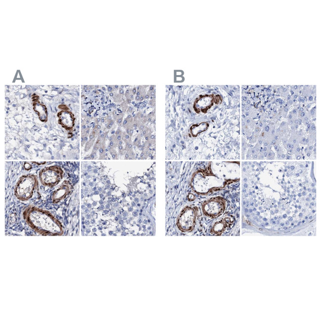 NRIP2 Antibody in Immunohistochemistry (IHC)