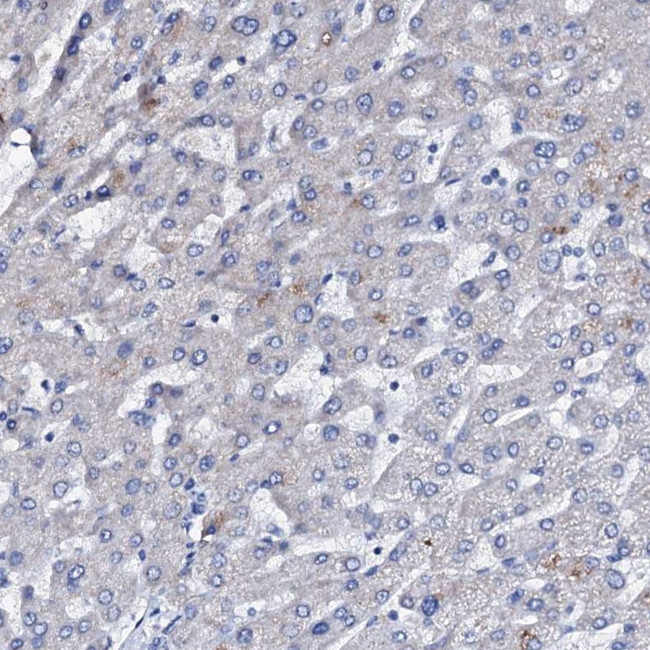 NRIP2 Antibody in Immunohistochemistry (IHC)