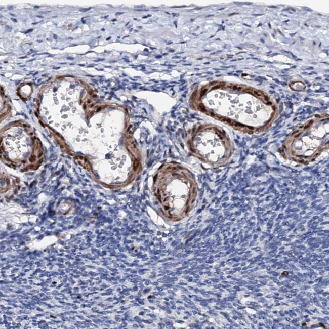 NRIP2 Antibody in Immunohistochemistry (IHC)