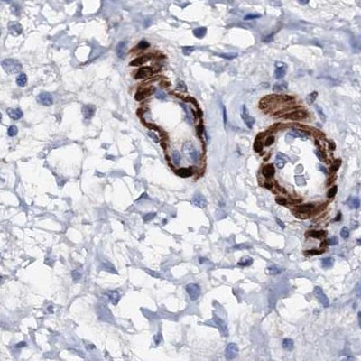 NRIP2 Antibody in Immunohistochemistry (IHC)