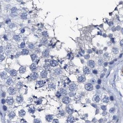 NRIP2 Antibody in Immunohistochemistry (IHC)